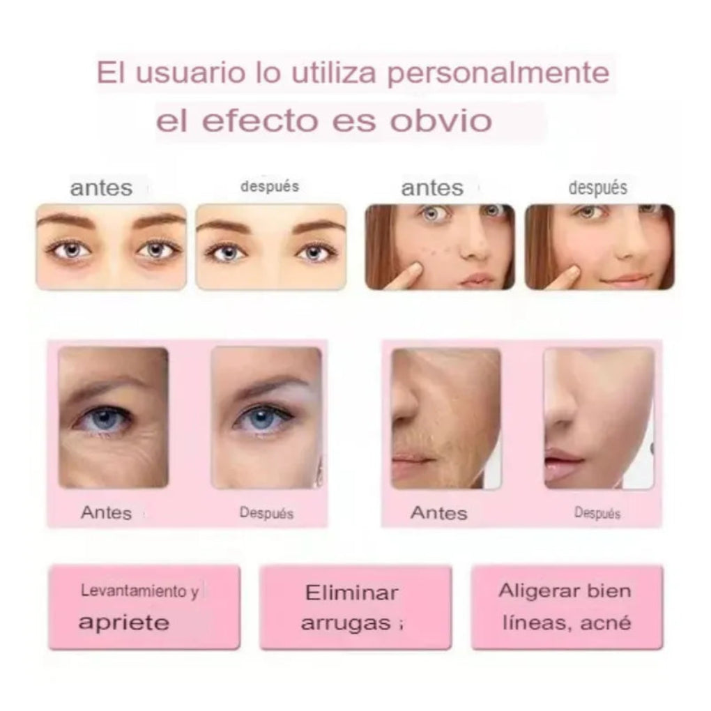 Masajeador Facial Ultrasónico 4 en 1