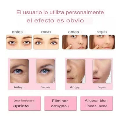 Masajeador Facial Ultrasónico 4 en 1