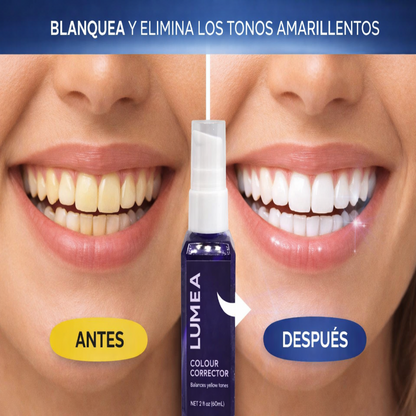 Lumea blanqueador dental