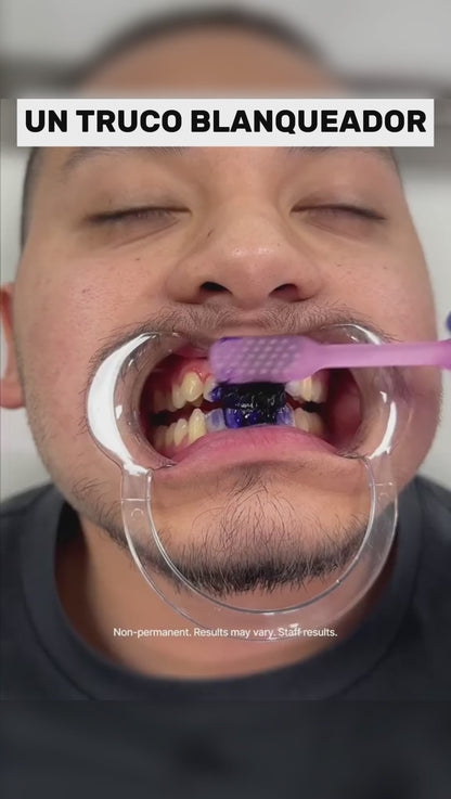Lumea blanqueador dental